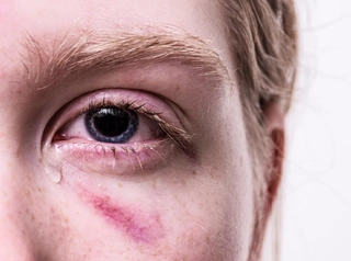 Symptoms of Childhood Molestation